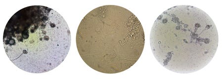 Enfermedad de transmisión sexual microscópica STD de la opinión del aspergillus de los hongos foto de archivo libre de regalías Enfermedad de transmisión sexual microscópica STD de la opinión del aspergillus de los hongos foto de archivo libre de regalías