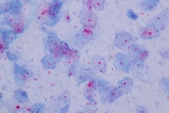 Epithelial δομή κυττάρων κυττάρων Squamous του ανθρώπου κάτω από την άποψη μικροσκοπίων για την εκπαίδευση στο εργαστήριο στοκ φωτογραφίες Epithelial δομή κυττάρων κυττάρων Squamous του ανθρώπου κάτω από την άποψη μικροσκοπίων για την εκπαίδευση στο εργαστήριο στοκ φωτογραφίες