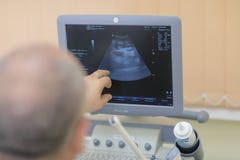 The doctor checks the patient for ultrasound royalty free stock image The doctor checks the patient for ultrasound royalty free stock image