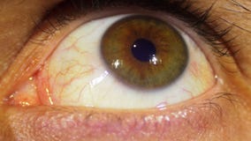 pulsating eyeballs pulsating eyeballs