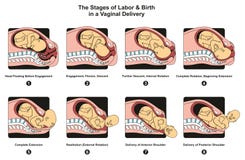 Fasi di lavoro e della nascita in una consegna vaginale illustrazione vettoriale Fasi di lavoro e della nascita in una consegna vaginale illustrazione vettoriale