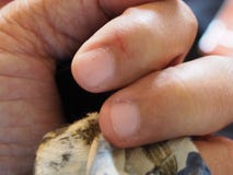 A ferida que é causada por um corte afiado no indicador está sangrando imagem de stock A ferida que é causada por um corte afiado no indicador está sangrando imagem de stock
