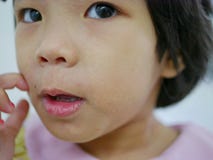 Fermez-vous de peu de bébé asiatique rayant sur son visage allergique, comme il a obtenu des éruptions rendant sa peau faciale sè image libre de droits Fermez-vous de peu de bébé asiatique rayant sur son visage allergique, comme il a obtenu des éruptions rendant sa peau faciale sè image libre de droits