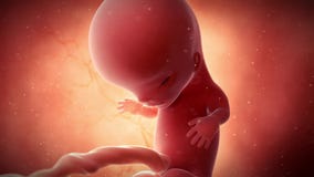 A fetus - week 11