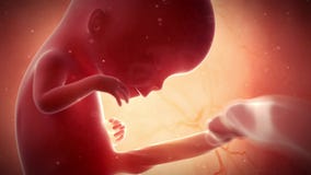 A fetus - week 12