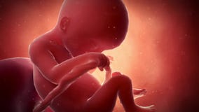 A fetus - week 18