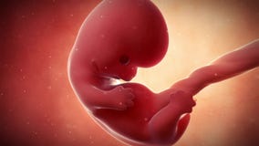A fetus - week 8