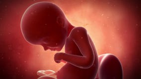 A fetus - week 29