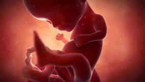 A fetus - week 14