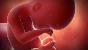 A fetus - week 19