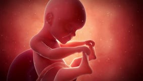 A fetus - week 25