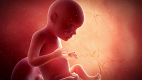A fetus - week 28