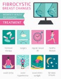 Fibrocystic Brust ändert Krankheit, medizinisches infographic Diagnos vektor abbildung Fibrocystic Brust ändert Krankheit, medizinisches infographic Diagnos vektor abbildung
