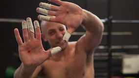 Verslinden Lijm pond Fitness Man Showing Hands with Calluses and Plasters on Fingers after  Workout Stock Video - Video of plaster, exercise: 117737275
