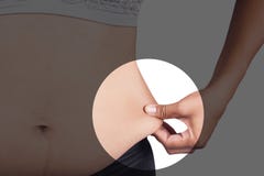 FrauenKörperfettbauch Stockbild FrauenKörperfettbauch Stockbild