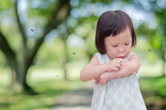 Girl Has Allergies With Mosquitoes Bite Stock Photo