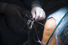 Gocciolamento ortopedico di artroscopia del ginocchio della chirurgia di traumatologia immagini stock Gocciolamento ortopedico di artroscopia del ginocchio della chirurgia di traumatologia immagini stock