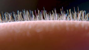 goosebumps-close-up-hair-his-hand-stand-static-electricity-light-fall-body-224489742.jpg