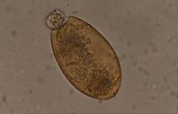 Groot de parasietei van groottefasciola stock afbeeldingen Groot de parasietei van groottefasciola stock afbeeldingen