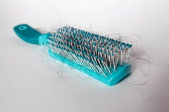 Hair fall out. Hairbrush with hair on a white background. Comb in hand. stock photos Hair fall out. Hairbrush with hair on a white background. Comb in hand. stock photos