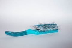 Hair fall out. Hairbrush with hair on a white background. Comb in hand. stock image Hair fall out. Hairbrush with hair on a white background. Comb in hand. stock image