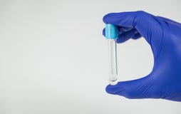 Hand van een arts die een fles voor steekproeven houden stock afbeelding Hand van een arts die een fles voor steekproeven houden stock afbeelding