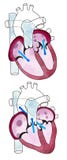 Hart, ventrikels, menselijke anatomie, hartventrikels vector illustratie Hart, ventrikels, menselijke anatomie, hartventrikels vector illustratie