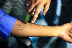 Hautallergie-Testvorbereitung durch Doktor auf einer geduldigen Hand, die der allergischen Überempfindlichkeitsreaktion wheal Sch lizenzfreie stockfotos Hautallergie-Testvorbereitung durch Doktor auf einer geduldigen Hand, die der allergischen Überempfindlichkeitsreaktion wheal Sch lizenzfreie stockfotos