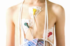 Heart electrocardiogram or monitoring using Holter for young patient stock photography Heart electrocardiogram or monitoring using Holter for young patient stock photography