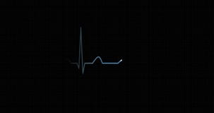 Heart rhythm EKG, ECG. Heart beat pulse.