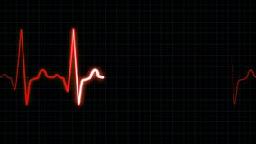 Heartbeat line, loop animation