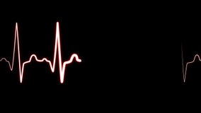 Heartbeat monitor EKG line monitor shows heartthrob