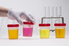 Het smeren van test van urine op laboratorium royalty-vrije stock afbeeldingen Het smeren van test van urine op laboratorium royalty-vrije stock afbeeldingen