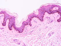 Histologi av det mänskliga silkespappret Royaltyfri Foto Histologi av det mänskliga silkespappret Royaltyfri Foto