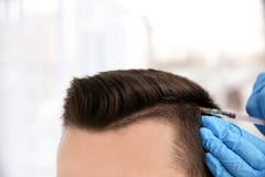 Hombre joven con el problema de la pérdida de pelo que recibe la inyección foto de archivo libre de regalías Hombre joven con el problema de la pérdida de pelo que recibe la inyección foto de archivo libre de regalías