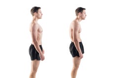 Homme avec le défaut altéré de position de posture Photos libres de droits Homme avec le défaut altéré de position de posture Photos libres de droits