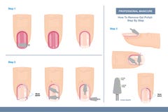 How To Remove Gel Polish. Position of Cone Shape Milling Cutter. Top View. Tips and Tricks. Professional Manicure Guide. Vector