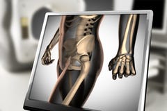 Human bones radiography scan image stock photography Human bones radiography scan image stock photography