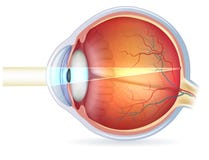 Human eye cross section, normal vision
