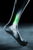 Human foot ankle and leg in x-ray, on gray background royalty free stock images Human foot ankle and leg in x-ray, on gray background royalty free stock images