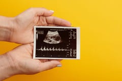Image d'ultrason de bébé chez le ventre de la femme image libre de droits Image d'ultrason de bébé chez le ventre de la femme image libre de droits