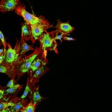 Imaging of metastatic cancer cells