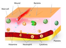 Inflammation. innate immune system