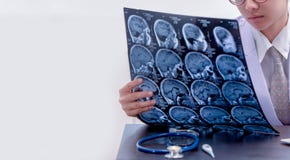 Jonge vrouwelijke artsenholding MRI of CT aftastenbeeld stock foto's Jonge vrouwelijke artsenholding MRI of CT aftastenbeeld stock foto's