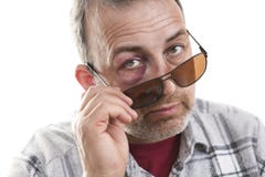Kaukasisch mannelijk Emotioneel Portret op middelbare leeftijd met een Echte Kneuzing stock foto's Kaukasisch mannelijk Emotioneel Portret op middelbare leeftijd met een Echte Kneuzing stock foto's