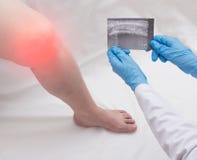 L'ortopedico di medico tiene un'immagine di ultrasuono di una donna che ha un ginocchio irritato Gonarthrosis, artrite, primo pia immagini stock L'ortopedico di medico tiene un'immagine di ultrasuono di una donna che ha un ginocchio irritato Gonarthrosis, artrite, primo pia immagini stock