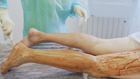 La mano alta vicina dell'infermiere disinfetta la gamba paziente prima della stanza in funzione della chirurgia video d archivio La mano alta vicina dell'infermiere disinfetta la gamba paziente prima della stanza in funzione della chirurgia video d archivio