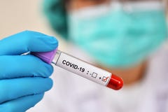 Lab technician holding blood sample tube positive with COVID-19 test