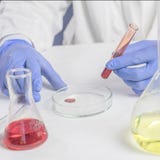 Lavoro di laboratorio, mani maschii che tengono una provetta, in guanti di gomma blu, un'analisi del sangue fotografia stock libera da diritti Lavoro di laboratorio, mani maschii che tengono una provetta, in guanti di gomma blu, un'analisi del sangue fotografia stock libera da diritti
