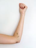 Le bras de la femme meurtrie sur le fond blanc, violence familiale image stock Le bras de la femme meurtrie sur le fond blanc, violence familiale image stock